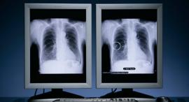 X-ray Equipments